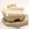 Dental Typodont Jaw / Model for Surgery Practice & Model for Surgery