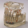 Dental Typodont Jaw / Model for Surgery Practice & Model for Surgery