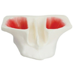 Sinus Lift model - White Resin & Model of jaw in white resin for sinus lifting