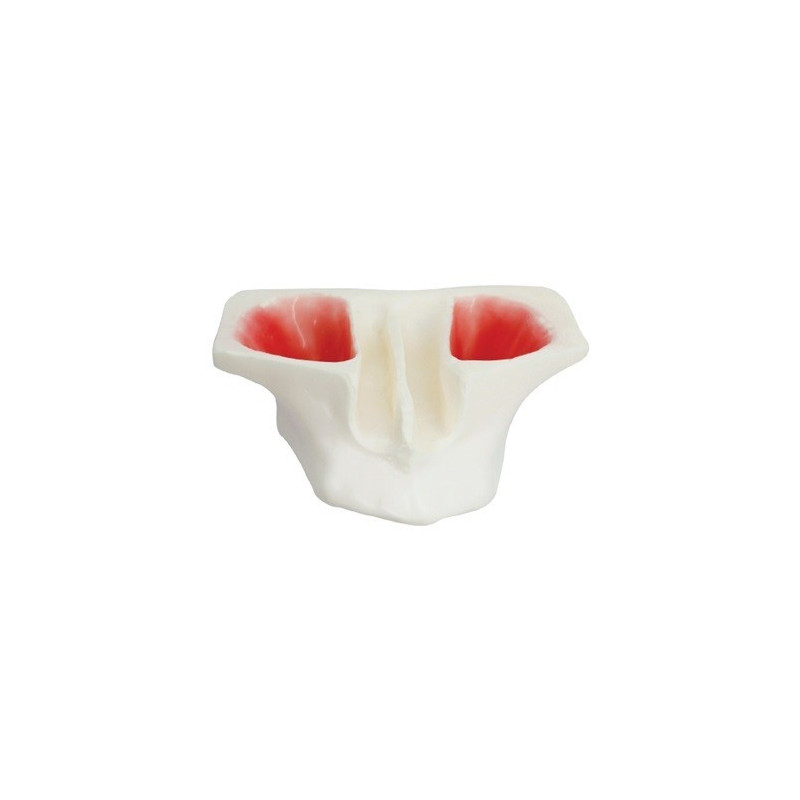 Sinus Lift model - White Resin & Model of jaw in white resin for sinus lifting