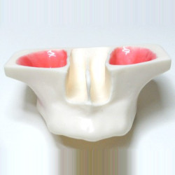 Sinus Lift model - White Resin & Model of jaw in white resin for sinus lifting