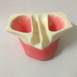 Sinus Lift model - White Resin & Model of jaw in white resin for sinus lifting