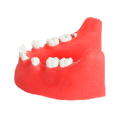 Impacted tooth Extraction Surgery Dental Jaw Model Only Lower Mandible