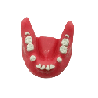 Impacted tooth Extraction Surgery Dental Jaw Model Upper and Lower set
