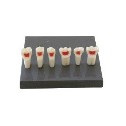 Paediatric Mixed Dentition Typodont Practice Jaw set & Pulpectomy practice teeth (set of 6 teeth)