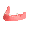 Mandible & Maxilla with Soft Gums for Implant Training & Mandible with gums
