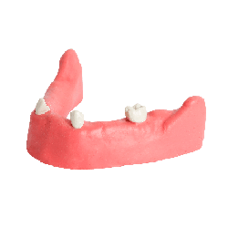 Mandible & Maxilla with Soft Gums for Implant Training & U+L Models with gums