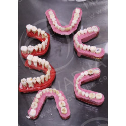 Dental Vice pair for Extracted Tooth & Magnetic or Screw in type Vice Pair