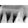Dental Vice pair for Extracted Tooth & Magnetic or Screw in type Vice Pair