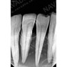Dental Vice pair for Extracted Tooth & Magnetic or Screw in type Vice Pair