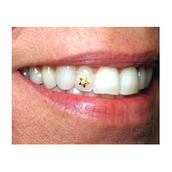 Dental Jewellery - Nike/ Tick - 22kt gold