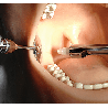 Oral Anaesthesia Training Manikin, Anesthesia