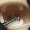 Oral Anaesthesia Training Manikin, Anesthesia