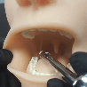 Oral Anaesthesia Training Manikin, Anesthesia