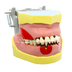 Columbia Synthetic Dental Calculus Syringe