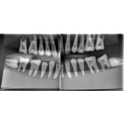Radiology X-ray training dental manikin with Bench mount Mankin