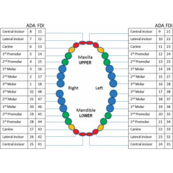 ADC exam caries teeth 5 M+O