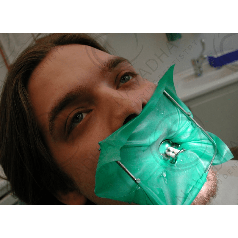 Dental Rubber Dam Sheets