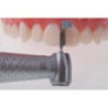 Directa FenderWedge Prep Dental Wedge & 36 pcs pack