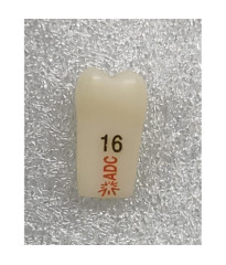 PLATINUM Caries Tooth 16M+O for ADC Model PRE ORDER