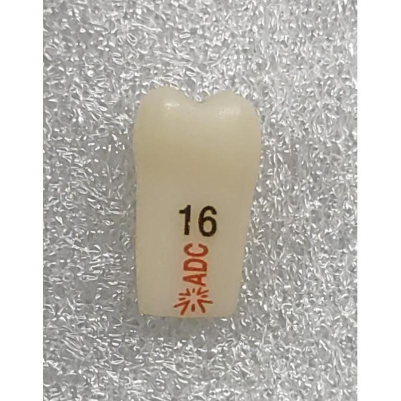 PLATINUM Caries Tooth 16M+O for ADC Model PRE ORDER