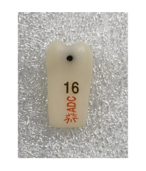 PLATINUM Caries Tooth 16 MO + DO for ADC Model PRE ORDER
