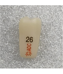 PLATINUM Caries Tooth 26M+O for ADC Model PRE ORDER