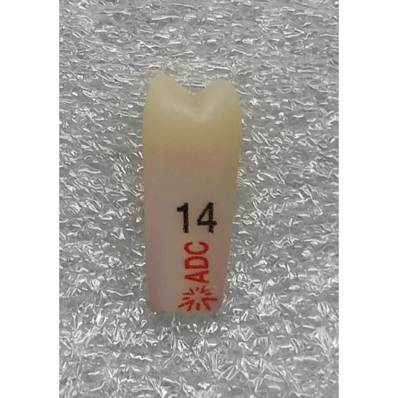 PLATINUM Endo Tooth 14 for ADC Model PRE ORDER