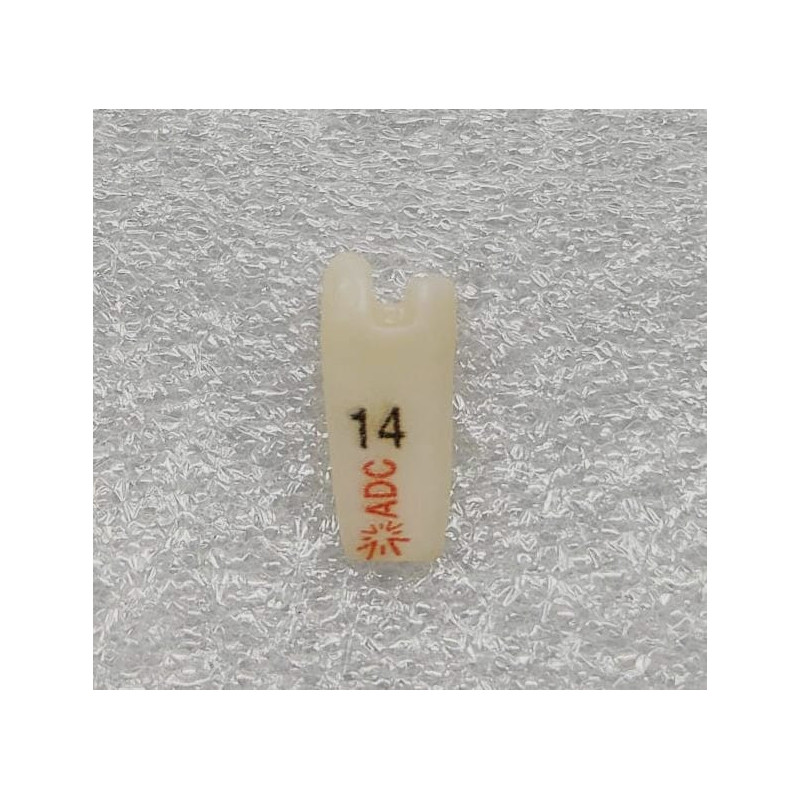 PLATINUM Prep Tooth 14MODB for ADC Model PRE ORDER