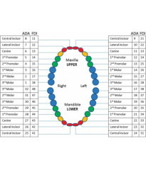 ADC exam caries teeth 9 Distal