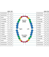 ADC exam caries teeth 5 M+O